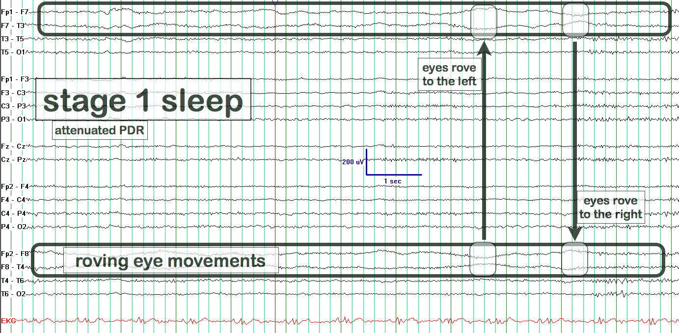 Drowsiness EEG example 1 annotated